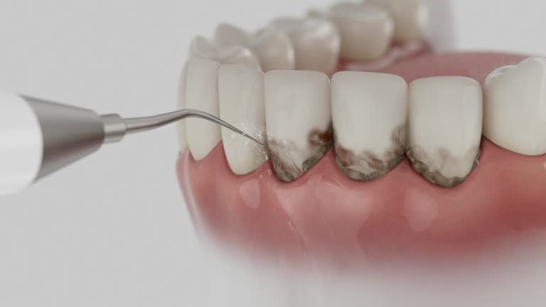 Reliable Dental Implants contractor in Needles, CA by Smile Center Dentistry